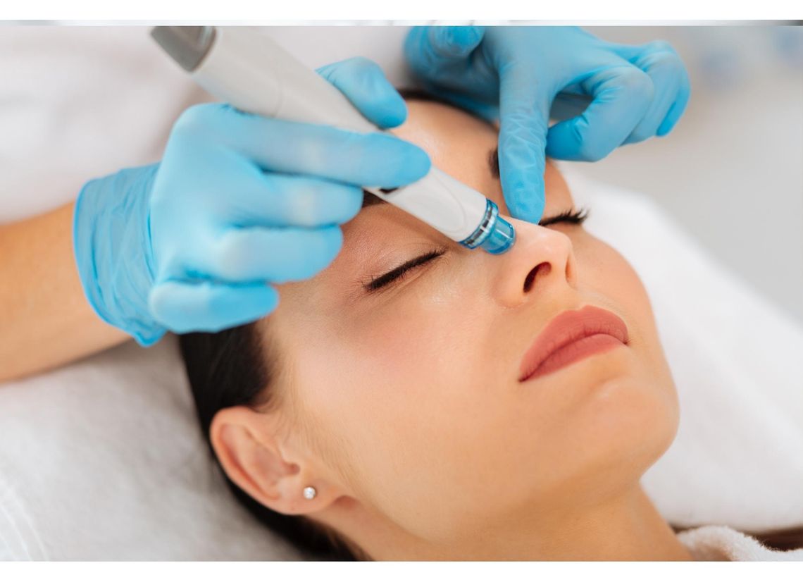 Kosmetikbehandlung Lörrach Microneedling Micro-needling Hautstraffung Pigmetstörungen straffen, Kosmetik, Hautverjüngung